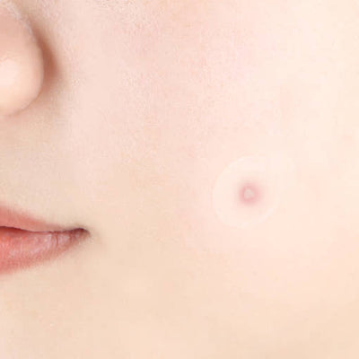 [Pyunkang Yul] Clear Spot Patch (18ea X 4ea) - application method